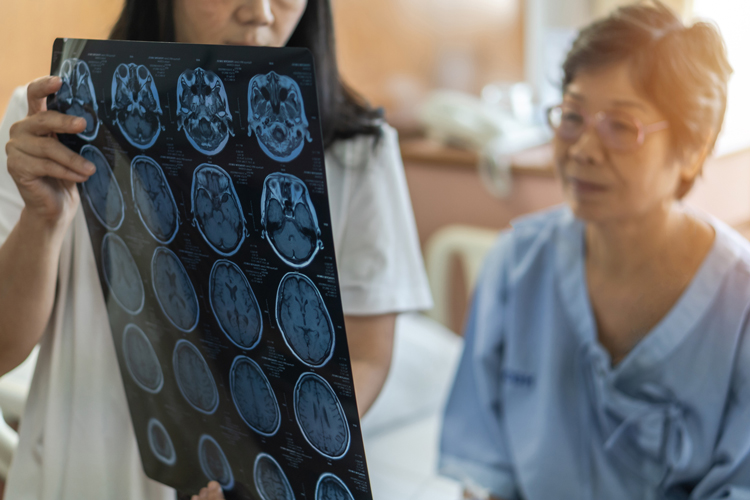 Head Trauma in Seniors Can Lead to Traumatic Brain Injuries | Care Tips